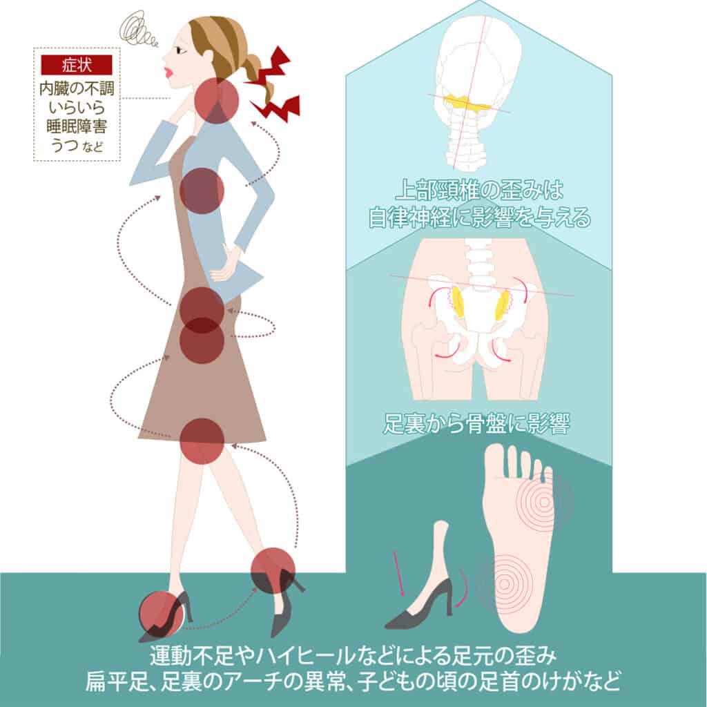 足裏から身体の歪みが生じることを伝えるイラスト